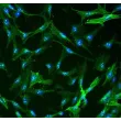 Human Hepatic Stellate Cells (HHSteC) - Immunostaining for α-SMA, 400x.
