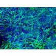 HiPSC-Derived Neurons (HiPSC-N) - Immunostaining for Tuj1, 200x