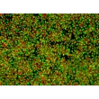 HiPSC-Derived Neural Stem Cells (HiPSC-NSC) - Immunostaining for Sox2+Tuj1, 200x