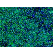 HiPSC-Derived Neural Stem Cells (HiPSC-NSC) - Immunostaining for Nestin, 200x
