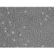 Human Intestinal Fibroblasts (HIF) - Phase contrast, 100x.
