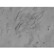 Human Intestinal Fibroblasts (HIF) - Relief contrast, 400x.
