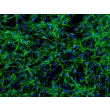 Human Intestinal Fibroblasts (HIF) - Immunostaining for Fibronectin, 200x.
