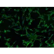 Human Iris Fibroblasts (HIrF)- Immunostaining for FN, 200X
