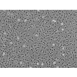 Human Keratocytes (HK) - Phase contrast, 100x.
