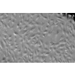 Human Lens Epithelial Cells (HLEpiC) - Relief contrast, 100x.
