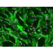 Human Lens Epithelial Cells (HLEpiC) – Immunostaining for CK-18, 200x.
