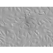 Human Mammary Epithelial Cells (HMEpiC) - Relief contrast, 400x.
