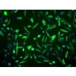 Human Mammary Epithelial Cells (HMEpiC) - Immunostaining for CK-18, 200x.
