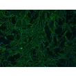 Human Mammary Fibroblasts (HMF) - Immunostaining for Fibronectin, 100x
