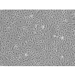 Human Mammary Microvascular Endothelial Cells (HMMEC) - Phase contrast, 100x.
