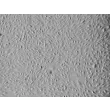 Human Mammary Microvascular Endothelial Cells (HMMEC) - Relief contrast, 100x.
