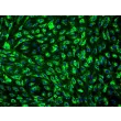 Human Mammary Microvascular Endothelial Cells (HMMEC) - Immunostaining for vWF, 200x.
