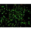 Human Middle Ear Epithelial Cells (HMEEpiC)-Immunostaining for CK-18, 200x
