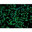 Human Middle Ear Fibroblasts (HMEF)-Immunostaining for FN, 200x