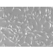 Human Middle Ear Fibroblasts (HMEF)-Relief Contrast, 200x