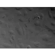 Human Myometrial Microvascular Endothelial Cells (HMMEC)-Relief Contrast, 400x.
