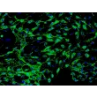 Human Myometrial Microvascular Endothelial Cells (HMMEC)-Immunostaining for vWF, 200x.
