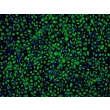 Human Non-Pigment Ciliary Epithelial Cells (HNPCEpiC) - Immunostaining for CK-18, 100x.
