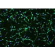 Human Oligodendrocyte Precursor Cells (HOPC) - Immunostaining for A2B5, 100x.
