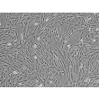 Human Ovarian Fibroblasts (HOF) - Phase contrast, 100x.
