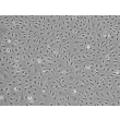 Human Ovarian Microvascular Endothelial Cells (HOMEC) - Phase contrast, 100x.
