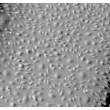 Human Ovarian Microvascular Endothelial Cells (HOMEC) - Relief contrast, 100x.
