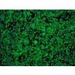Human Ovarian Microvascular Endothelial Cells (HOMEC) - Immunostaining for vWF, 100x.
