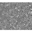 Human Ovarian Surface Epithelial Cells (HOSEpiC) - Phase contrast, 100x.
