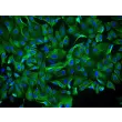 Human Ovarian Surface Epithelial Cells (HOSEpiC) - Immunostaining for CK-18, 400x.
