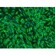 Human Pancreatic Microvascular Endothelial Cells (HPaMEC)-Immunostaining for vWF (Sigma-Aldrich Cat. #F3520), 200x.
