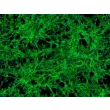 Human Pericardial Fibroblasts (HPcF) - Immunostaining for Fibronectin, 100x.
