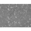 Human Perineurial Cells (HPNC) - Phase contrast, 100x.
