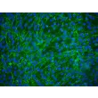 Human Peridontal Ligament Fibroblasts (HPLF) - Immunostaining for Fibronectin, 200x.
