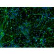 Human Pluripotent Stem Cell derived-Cortical Neurons immunostained for beta tubulin III (green) 200X