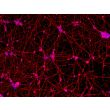Human Pluripotent Stem Cell Derived-GABAergic Neurons  (HPSC-GABAN) - immunostained for Tubb3 (red) 100X