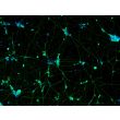 Human Pluripotent Stem Cell Derived-GABAergic Neurons  (HPSC-GABAN) - immunostained for GABA (green) 100X