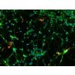 Human Pluripotent Stem Cell derived-Glutamatergic Neurons immunostained for vGLUT1 (red) and beta tubulin III (green) 200X