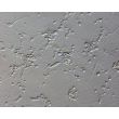 Human Pluripotent Stem Cell derived-Motor Neurons (HPSC-MN) - Relief Contrast 200X