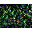 Human Pluripotent Stem Cell derived-Pericytes, immunostained for NG2 (green) and PDGFR-beta (red) 200X