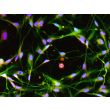 Human Pluripotent Stem Cell derived-Schwann Cells, immunostained for GFAP (red) and S100β (green) 200X