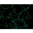 Human Pluripotent Stem Cell derived-Sensory Neurons (HPSC-SN) - immunostained for Tubb3 (green) 100X