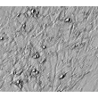 Relief contrast, 400x.