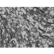 Intracellular lipid droplets are visible after differentiation, 400x.