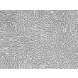 Human Preadipocytes-visceral (HPA-v) - Phase contrast, 100x.