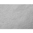 Human Preadipocytes-visceral (HPA-v) - Relief contrast, 100x.