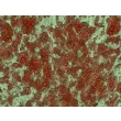 Human Preadipocytes-visceral (HPA-v) - Intracellular lipid droplets are visible after differentiation by Oil Red O staining, 400x.