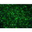 Human Prostate Epithelial Cells (HPrEpiC) - Immunostaining for CK-19, 100x..
