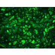 Human Prostate Epithelial Cells (HPrEpiC) - Immunostaining for CK-18, 200x.
