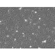 Human Pulmonary Alveolar Epithelial Cells-adult (HPAEpiC-a) - Phase contrast 100x